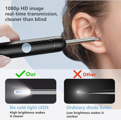 Smart Visual Earwax Cleaner with 1080P WiFi Camera & LED Light – Rechargeable Ear Cleaning Tool
