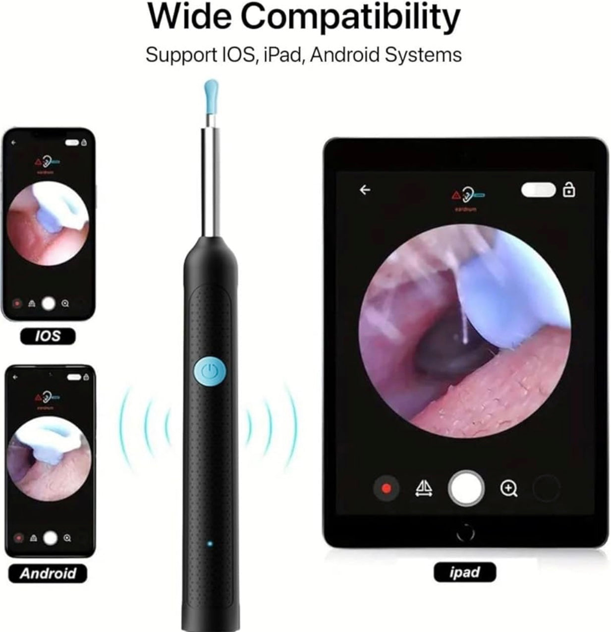 Smart Visual Earwax Cleaner with 1080P WiFi Camera & LED Light – Rechargeable Ear Cleaning Tool (RA-011)