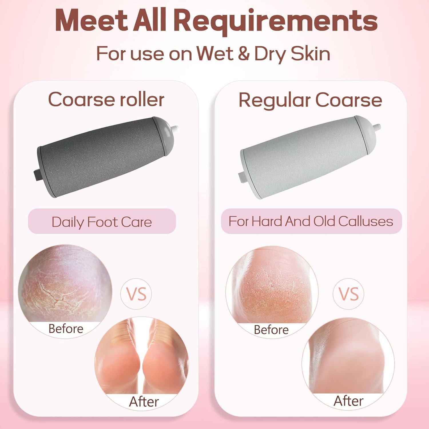 Electric Deadskin Remover For Feet (RA-068)